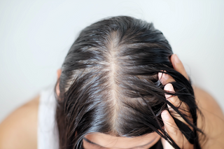 Here are 5 ways to combat oily hair.