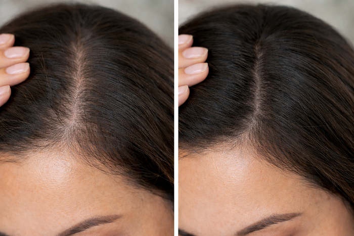 Understanding Hair Density & Internal Support