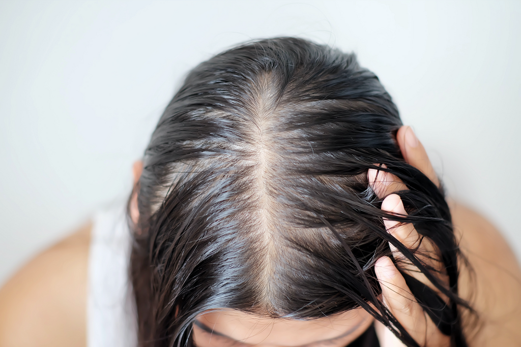 5 Ways to Combat Oily Hair