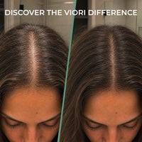 Rosemary Biotin Conditioner Bar – Thinning Hair | VIORI