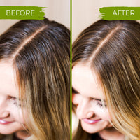 Tea Tree Shampoo Bar – Oily & Itchy Scalp | VIORI - angle 7