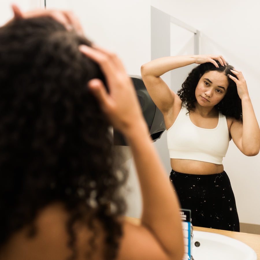 Dandruff — before and after