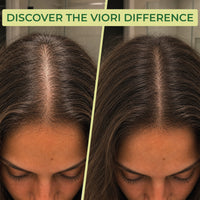 Tea Tree Conditioner Bar – Oily & Itchy Hair | VIORI