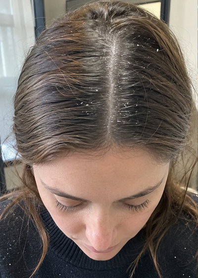 Saoirse — before