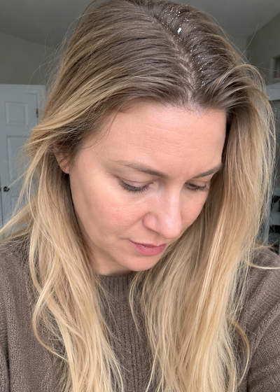 Maren — before