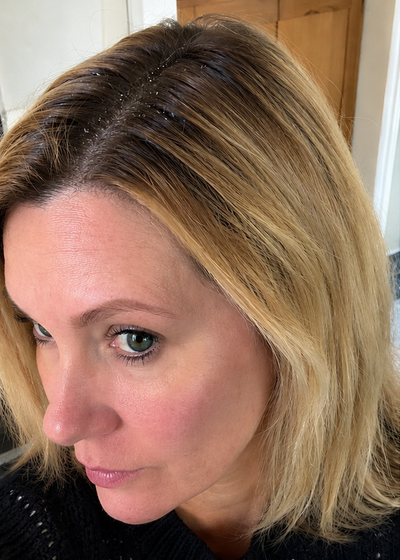 Claire T. — before