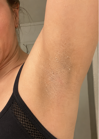 Reese — before