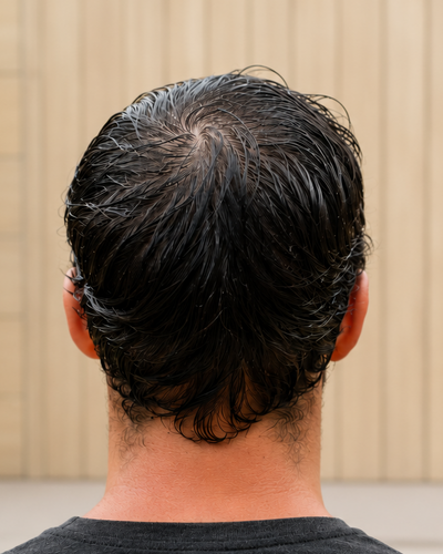 Customer — before