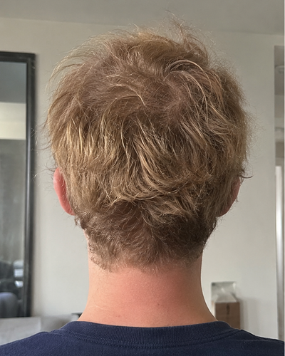 Customer — before