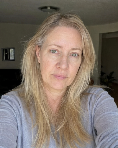 Allison R. — before