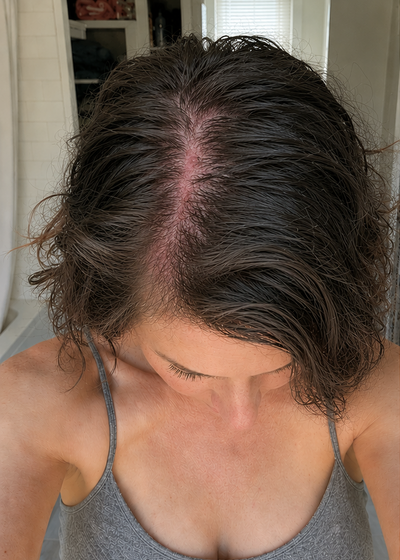 Dana — before